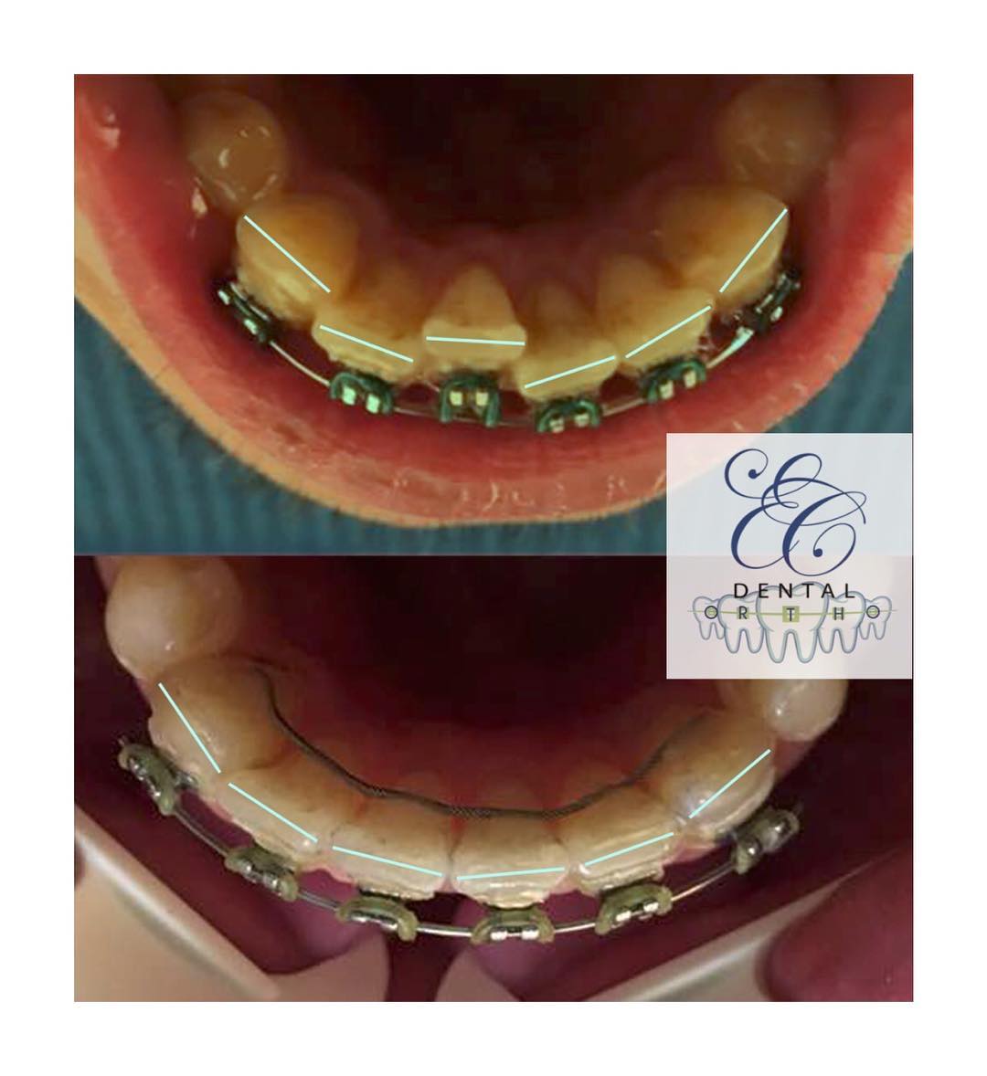 Chackal Dental Clinic