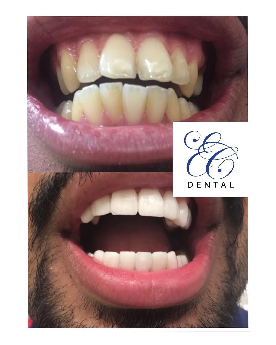 Chackal Dental Clinic