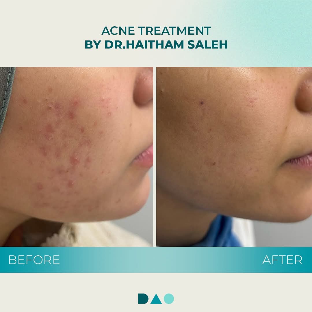 DAO Derma
