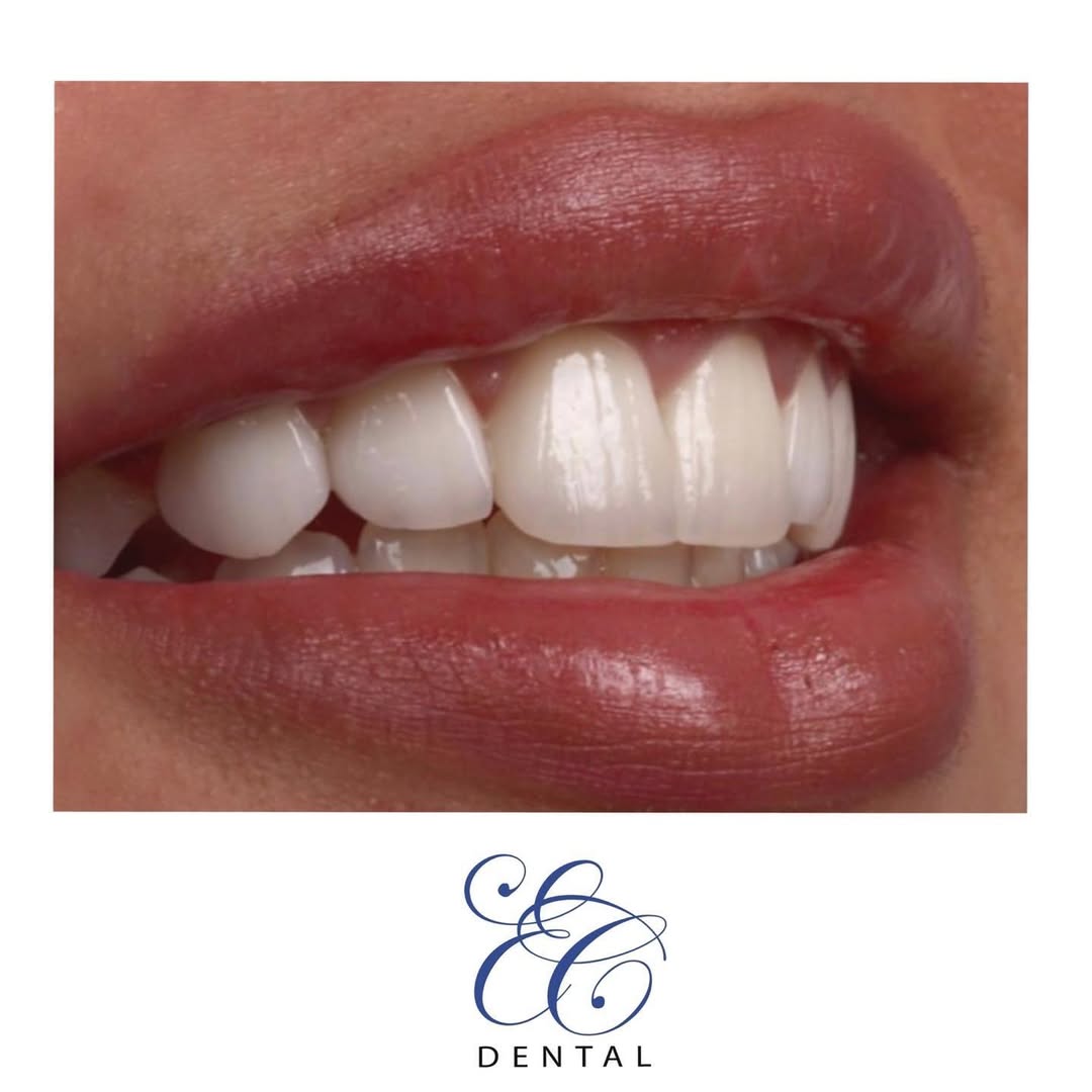 Chackal Dental Clinic