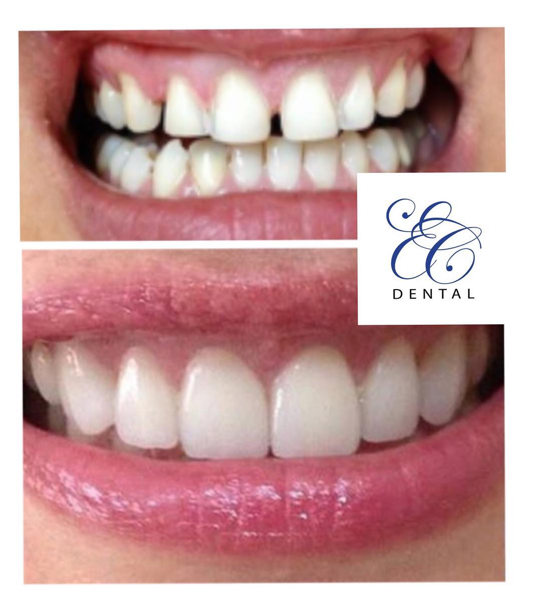 Chackal Dental Clinic