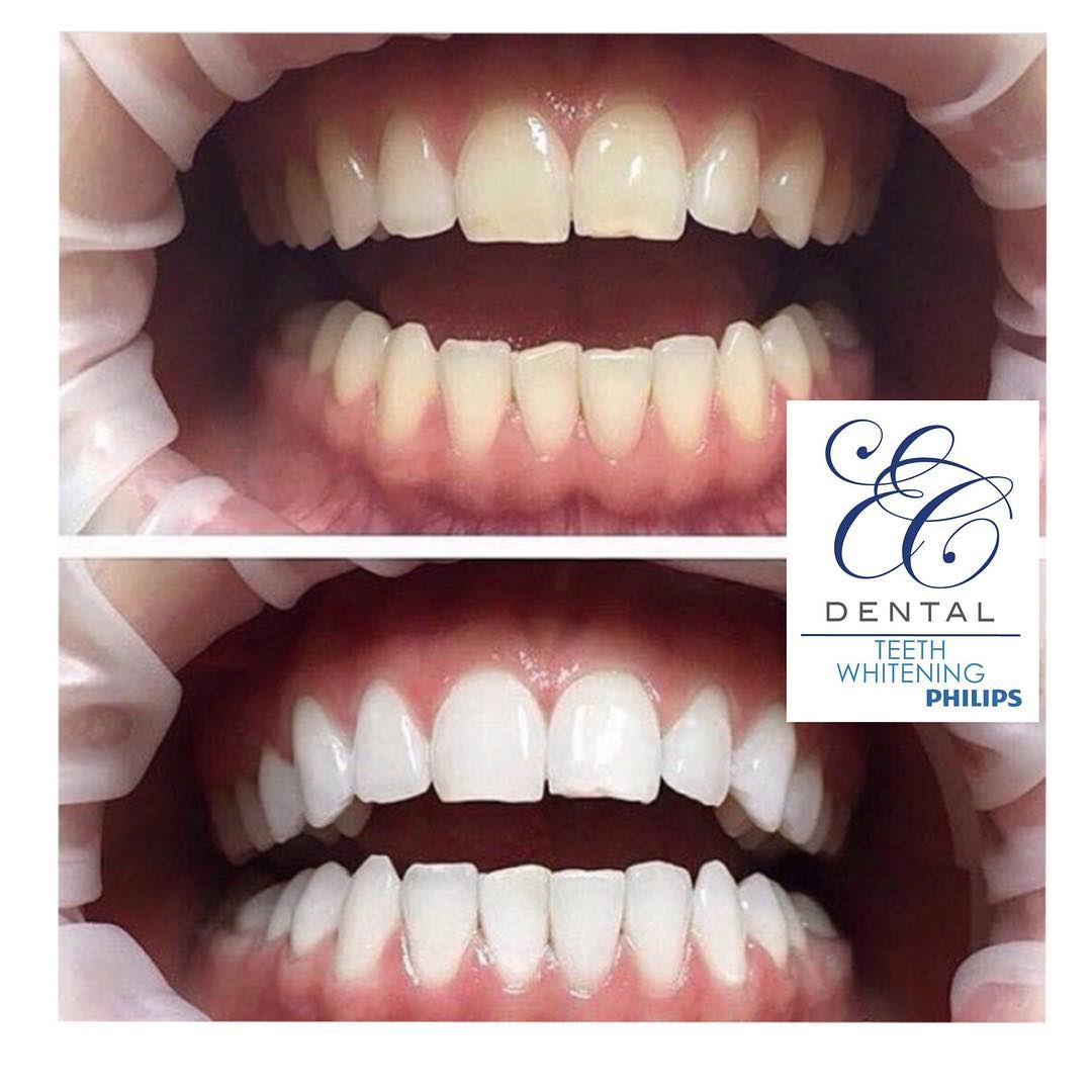 Chackal Dental Clinic